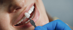Resinas Dentales Fotopolimerizables: Guía Completa de Tipos y Aplicaciones