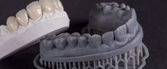 Cerámicas Dentales: Tipos y Aplicaciones en Prótesis Fija Moderna