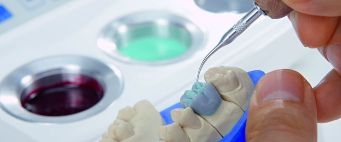 Ceras Dentales: Tipos y Aplicaciones en Técnicas de Laboratorio