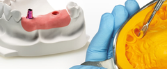 Siliconas Dentales por Adición vs Condensación: Comparativa Completa para Odontólogos