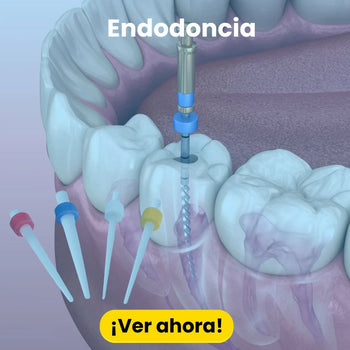 Endodoncia
