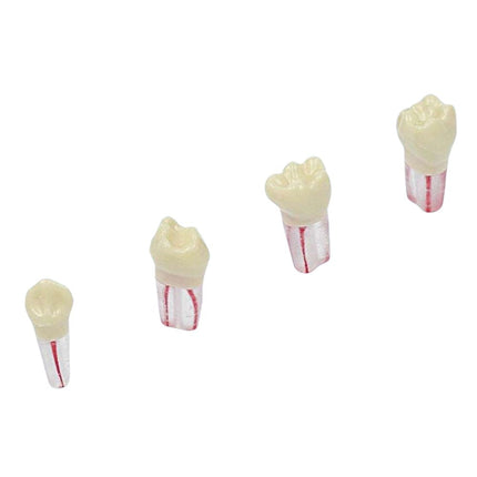 Diente De Endodoncia Blanco X Ud. El Diente De Endodoncia Blanco, es un material de estudio
