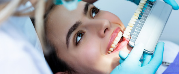 materiales de eblanqueamiento dental